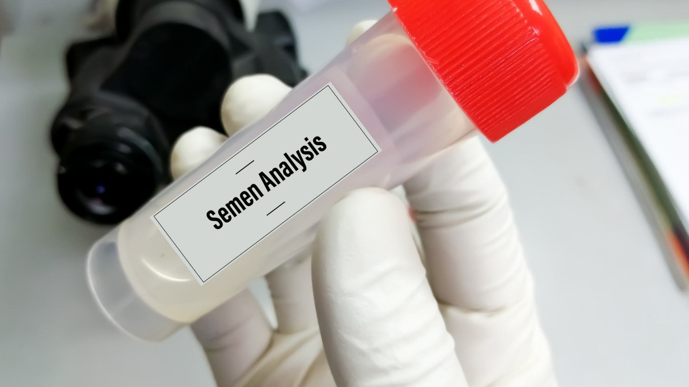 How to Read Post-Vasectomy Lab Results Correctly