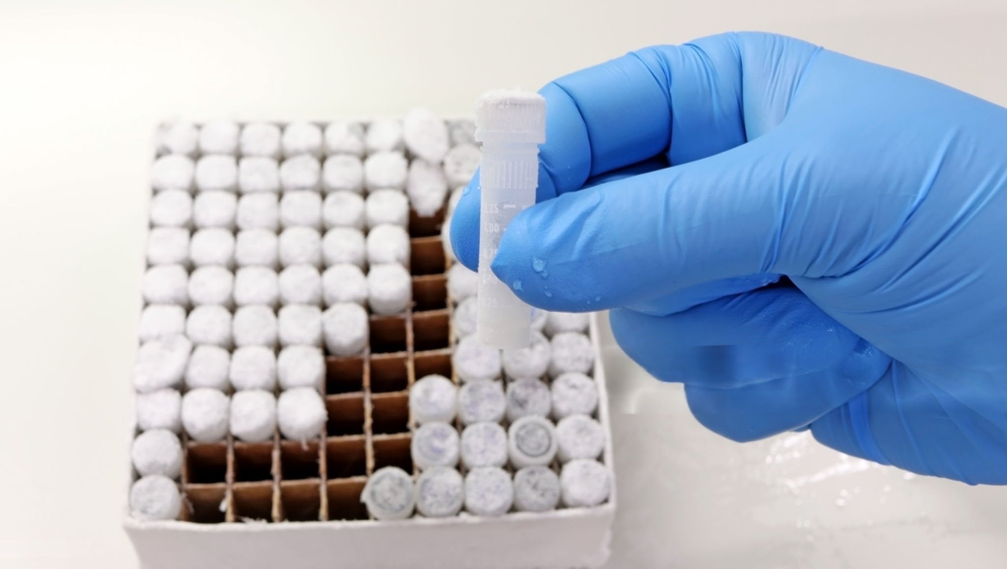 How Heat Impacts Sperm: New Science Unlocks Clues to Male Fertility