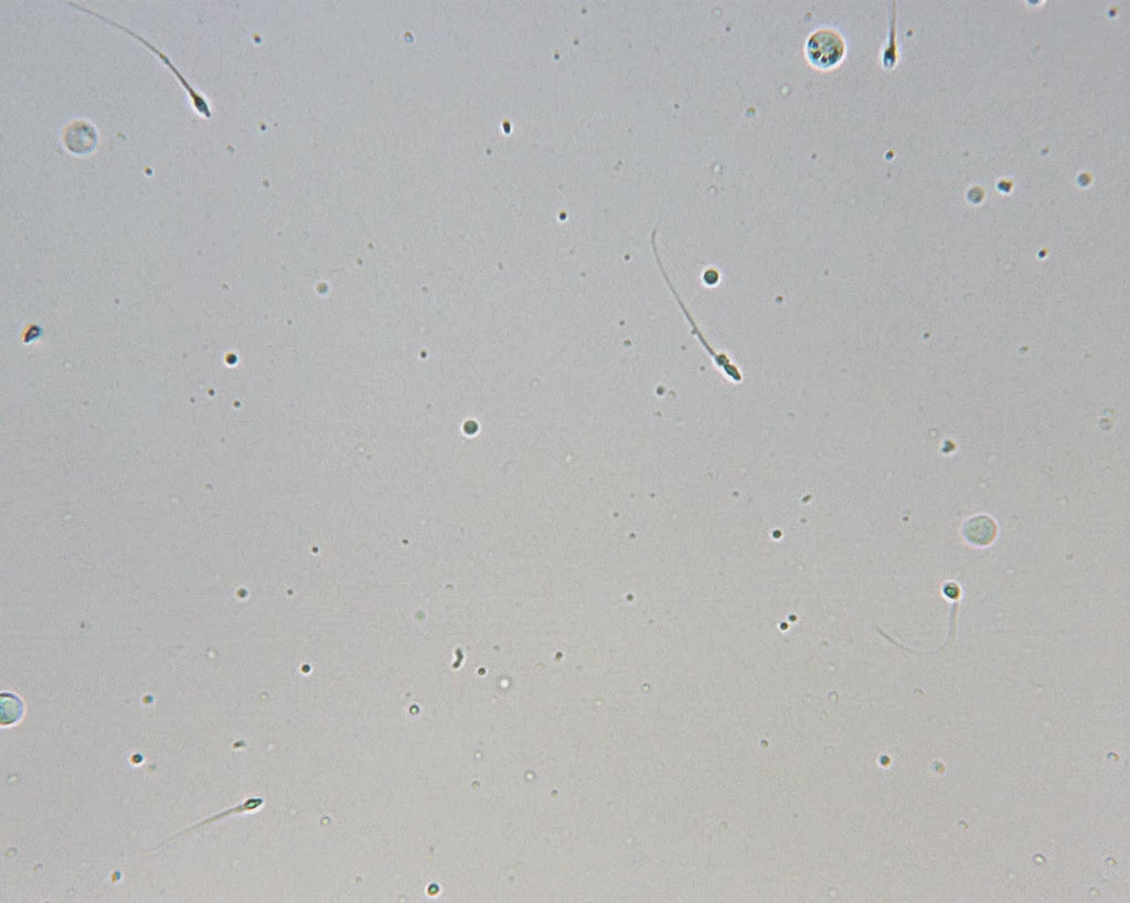 sperm test video